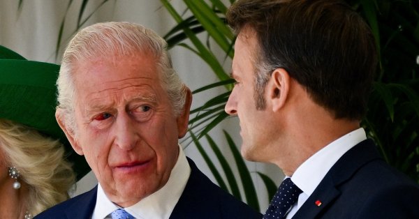 Король Чарльз с кровоточащим глазом приветствовал Макрона, что это из -за?