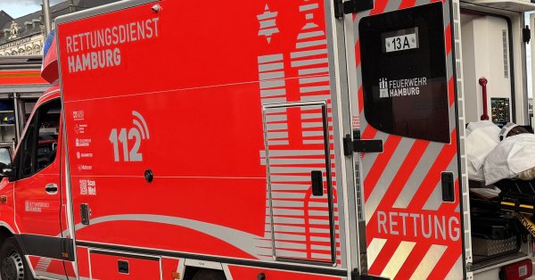 Ребенок 1,5 г.