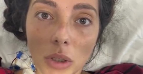 Албена, пострадавшая во время митинга под Варной, нуждается в помощи для лечения