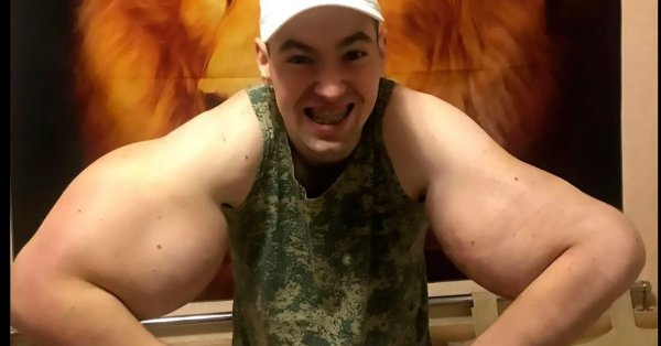 «Русский Папай», колющий себе в бицепс вазелин, может лишиться рук